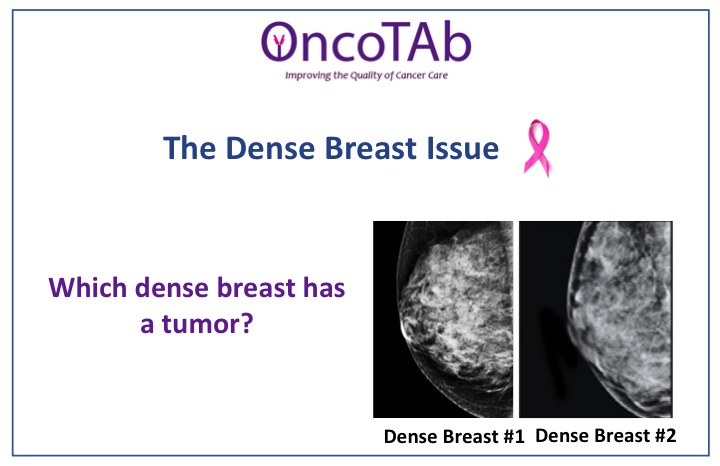 Dense Breast Tissue Cancer Screening